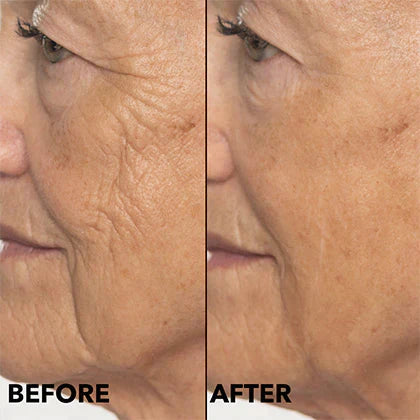 ✨Zakdavi™ Retinol Capsules Anti-Aging Night Retinol Face Serum Treatment - 30ct/0.35 fl oz