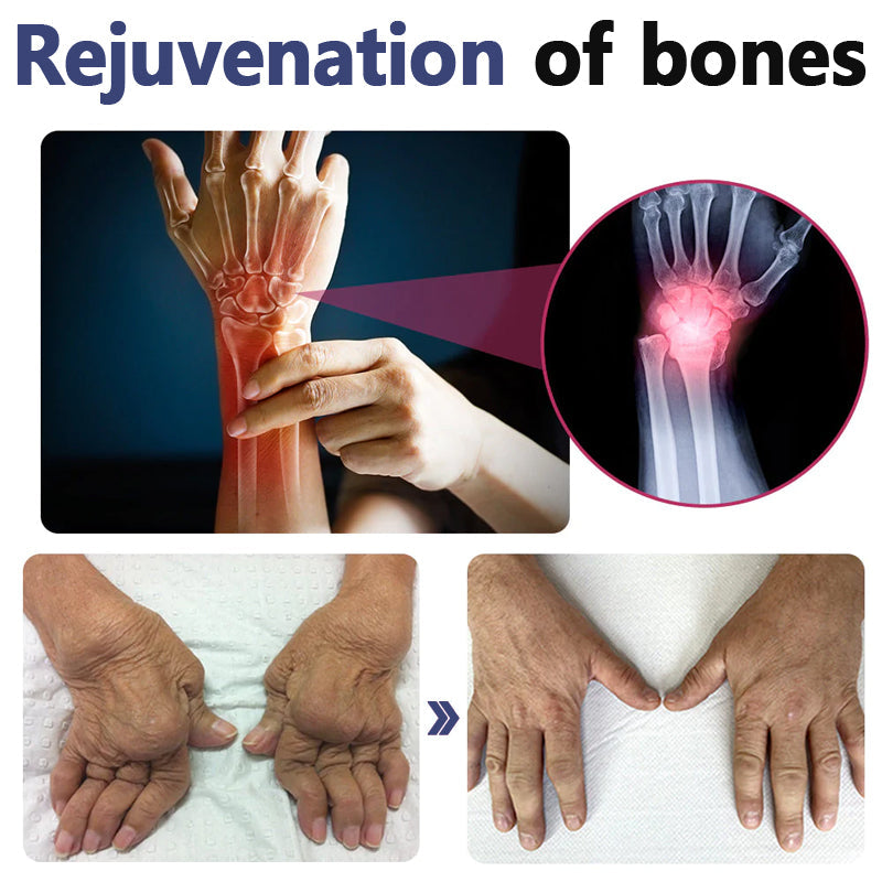 đBeeZen⢠New Zealand Bee Venom Joint and Bone Therapy Advanced CreamđLimited Time Offerđ